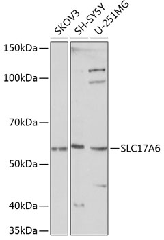 SLC17A6 Polyclonal Antibody