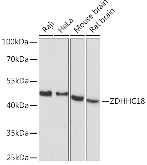 ZDHHC18 Polyclonal Antibody