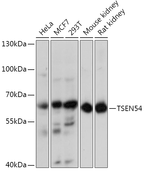 TSEN54 Polyclonal Antibody