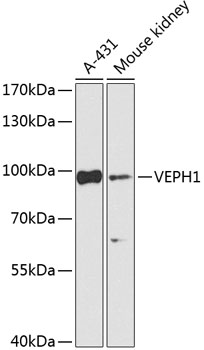 VEPH1 Polyclonal Antibody