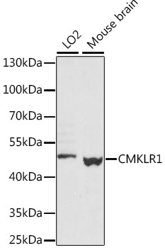 CMKLR1 Polyclonal Antibody