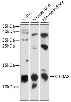 S100A8 Polyclonal Antibody