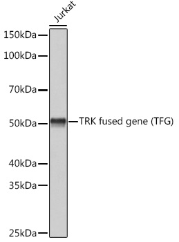 TRK fused gene (TFG) Monoclonal Antibody [0V5P10]