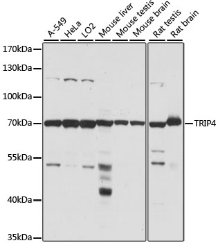 TRIP4 Polyclonal Antibody