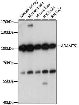 ADAMTS1 Polyclonal Antibody&nbsp;<img src="images/icon_newarrival.gif" alt="new" border="0">