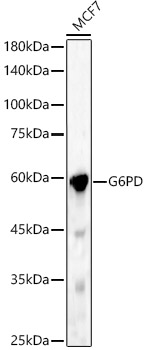 G6PD Polyclonal Antibody