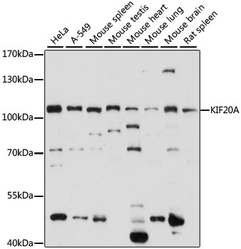KIF20A Polyclonal Antibody