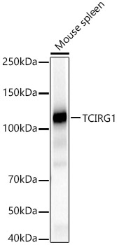 TCIRG1 Polyclonal Antibody