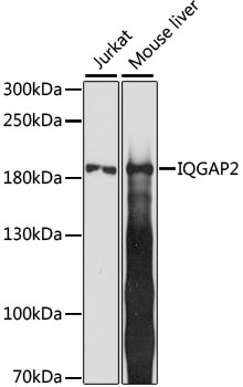 IQGAP2 Polyclonal Antibody