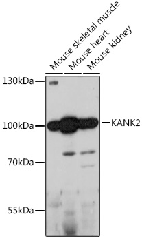 KANK2 Polyclonal Antibody