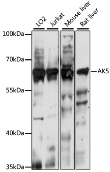 AK5 Polyclonal Antibody