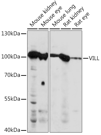 VILL Polyclonal Antibody