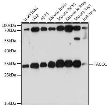 TACO1 Polyclonal Antibody