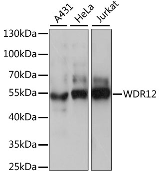 WDR12 Polyclonal Antibody