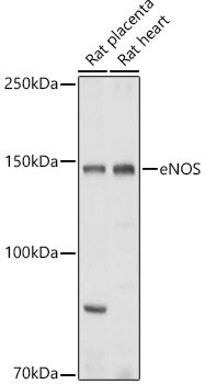 eNOS Polyclonal Antibody