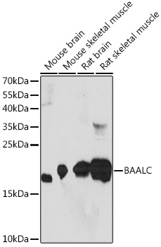 BAALC Polyclonal Antibody