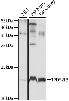 TPD52L3 Polyclonal Antibody