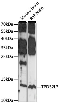 TPD52L3 Polyclonal Antibody