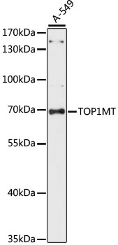 TOP1MT Polyclonal Antibody