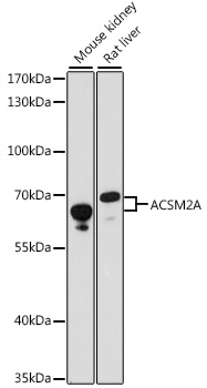 ACSM2A Polyclonal Antibody&nbsp;<img src="images/icon_newarrival.gif" alt="new" border="0">