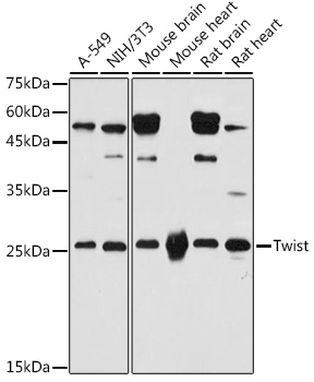 Twist Polyclonal Antibody