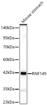 RNF149 Polyclonal Antibody