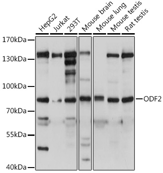 ODF2 Polyclonal Antibody