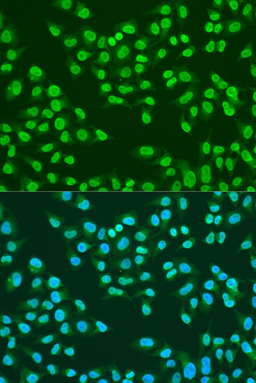 ATM Polyclonal Antibody