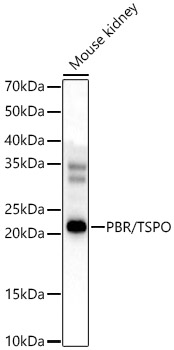 PBR/TSPO Polyclonal Antibody
