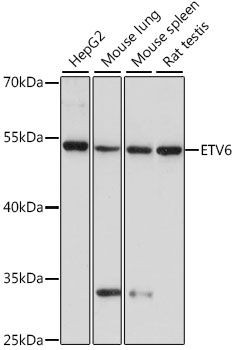 ETV6 Polyclonal Antibody