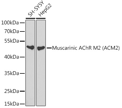 Muscarinic AChR M2 (ACM2) Polyclonal Antibody