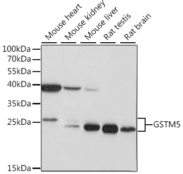 GSTM5 Polyclonal Antibody