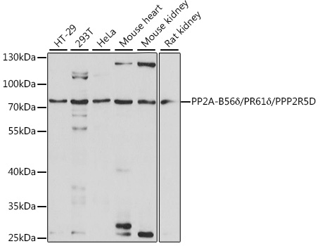 PP2A-B56-delta/PR61-delta/PPP2R5D Polyclonal Antibody