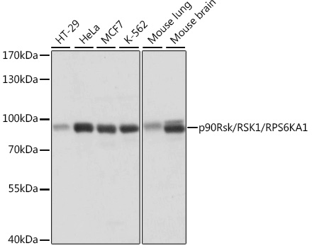 p90Rsk/RSK1/RPS6KA1 Polyclonal Antibody
