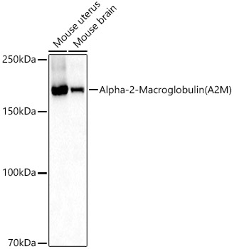 Alpha-2-Macroglobulin (A2M) Polyclonal Antibody