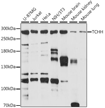 TCHH Polyclonal Antibody