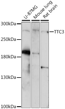 TTC3 Polyclonal Antibody