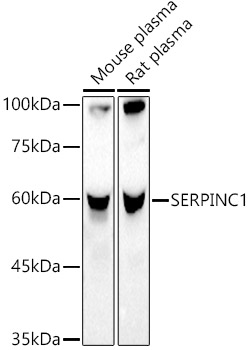 SERPINC1 Polyclonal Antibody