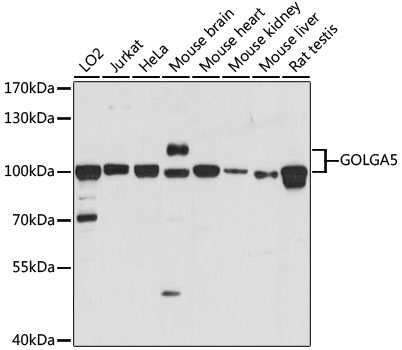 GOLGA5 Polyclonal Antibody