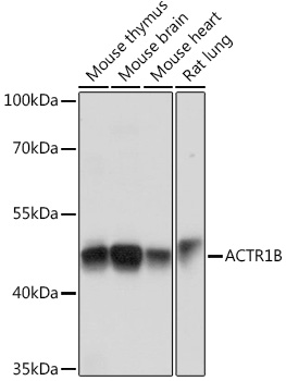 ACTR1B Polyclonal Antibody&nbsp;<img src="images/icon_newarrival.gif" alt="new" border="0">