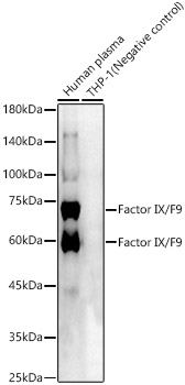 Factor IX / F9 Polyclonal Antibody