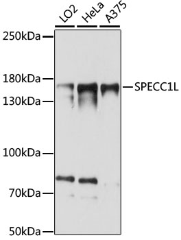 SPECC1L Polyclonal Antibody
