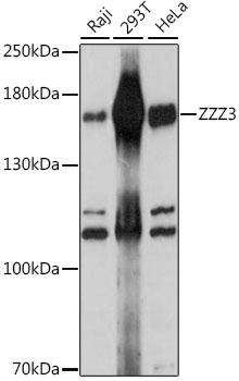 ZZZ3 Polyclonal Antibody