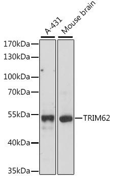 TRIM62 Polyclonal Antibody