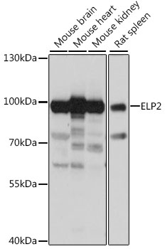 ELP2 Polyclonal Antibody