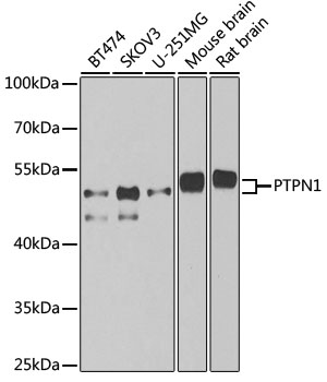 PTPN1 Polyclonal Antibody