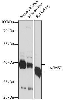 ACMSD Polyclonal Antibody&nbsp;<img src="images/icon_newarrival.gif" alt="new" border="0">