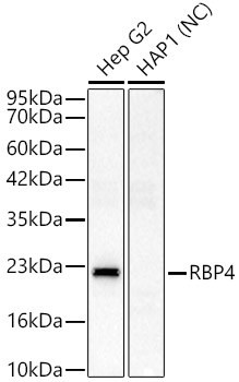 RBP4 Polyclonal Antibody