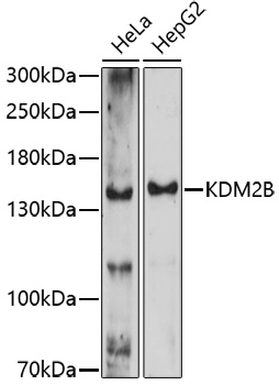 KDM2B Polyclonal Antibody