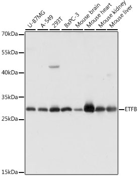 ETFB Polyclonal Antibody